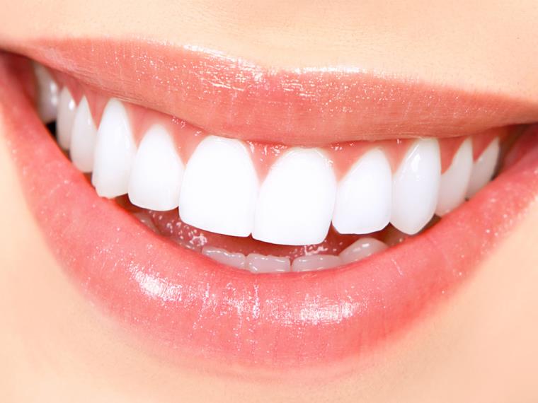 歯のホワイトニング歯科医-健康保護製品