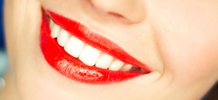 sorriso-bianco-denti-cura