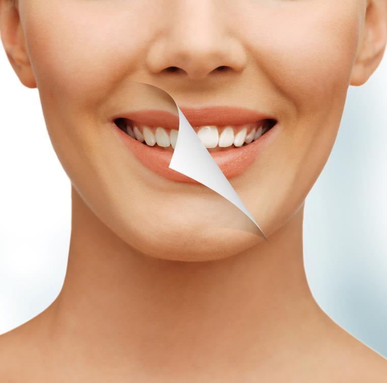 baltų dantų grožio priežiūra