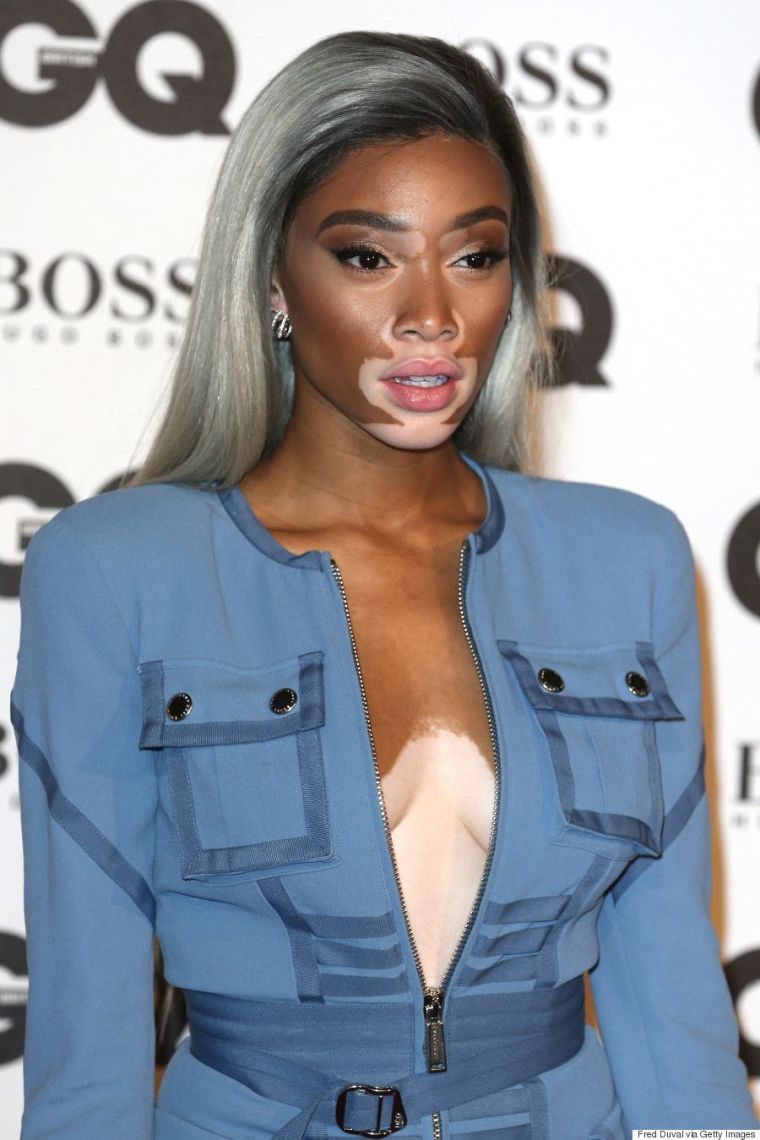 Winnie Harlow modern frizuraötletek szürke hajra