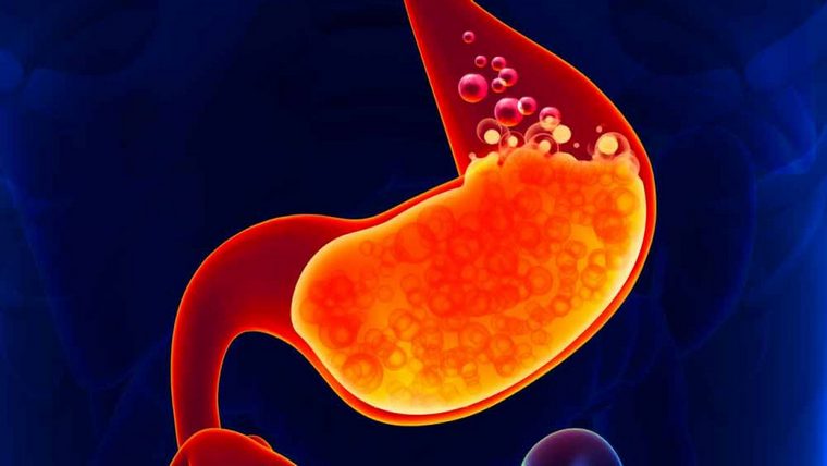 laryngopharyngealis reflux torokfájás